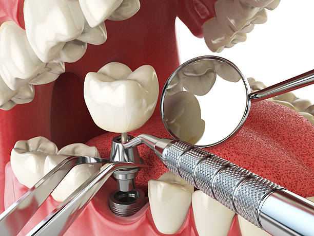 Best Emergency Root Canal Therapy in Braddock, PA